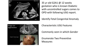 Fetal Anomalies in Pregnancy