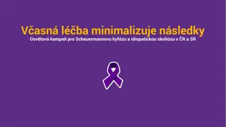 Insights on Scheuermann's Disease and Idiopathic Scoliosis