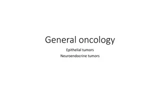 Epithelial Tumors: Classification, Behavior, and Spread