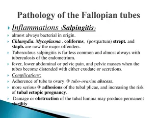 Overview of Salpingitis, Fallopian Tube Cancer, Polycystic Ovaries, and Ovarian Neoplasms