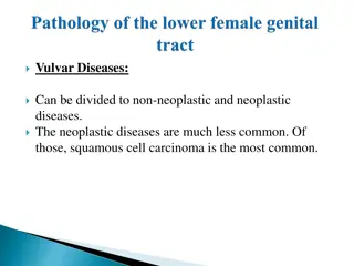 Vulvar Diseases: Non-Neoplastic and Neoplastic Conditions