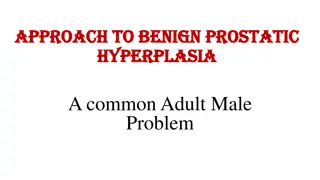 Benign Prostatic Hyperplasia: Symptoms, Diagnosis, and Treatment