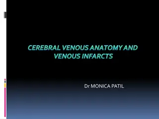 Cerebral Venous Anatomy and Infarcts