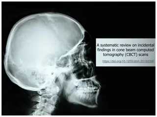 Incidental Findings in Cone Beam Computed Tomography Scans: A Review