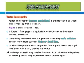 Vortex Keratopathy: Symptoms, Causes, and Toxic Effects