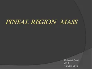 Pineal Region Mass: Signs, Symptoms, and Imaging Findings