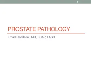 Prostate Pathology