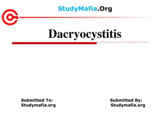 Dacryocystitis