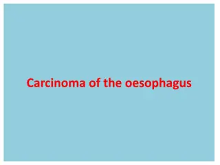 Oesophageal Carcinom