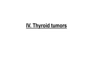 Thyroid Nodules and Tumors