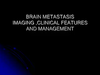 Brain Metastasis: Imaging, Clinical Features & Management