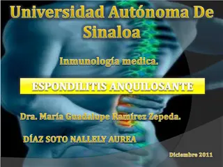 Ankylosing Spondylitis: Historical Descriptions and Epidemiology