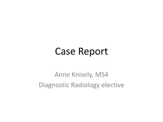 Case Report: Diagnosis and Management of Bilateral PE in a 69-Year-Old Female