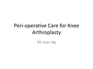 Comprehensive Guide to Knee Arthroplasty Peri-operative Care
