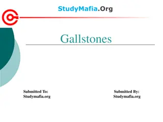 Comprehensive Guide to Gallstones: Types, Symptoms, and Prevention