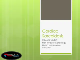 Cardiac Sarcoidosis