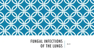 Fungal Lung Infections