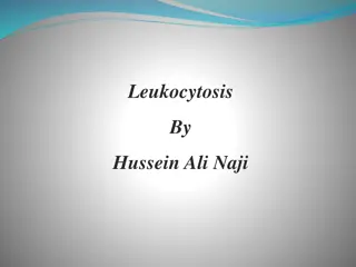 Leukocytosis and Left Shifts in White Blood Cells