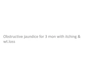 Obstructive Jaundice: Symptoms, Diagnosis, and Treatment