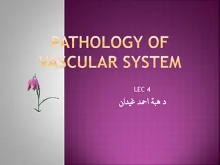 Vascular Disorders: Raynaud's & Hemangiomas