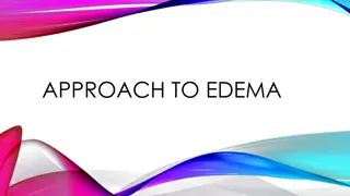 Edema: Causes, Mechanisms, and Management