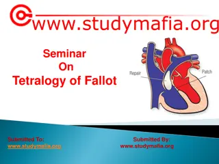 Tetralogy of Fallot: Symptoms, Causes, and Treatment