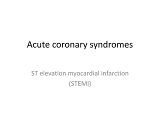 STEMI: Diagnosis and Management