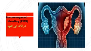 Postmenopausal Bleeding: Causes and Management