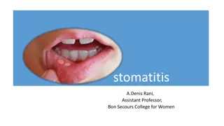Stomatitis: Causes, Symptoms, and Treatment
