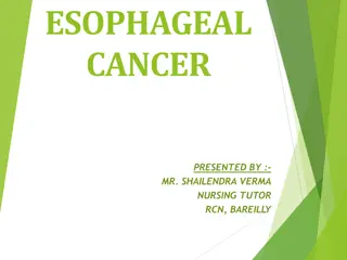 Esophageal Cancer