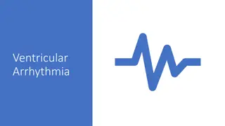 Overview of Ventricular Arrhythmia and Management