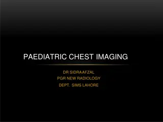 Genetic Heart Muscle Disease & Left Ventricular Hypertrophy
