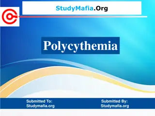 Polycythemia Vera: Symptoms, Causes, and Treatment