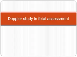 Doppler Studies in Pregnancy for Fetal Assessment