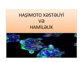 Hashimoto's Disease and Pregnancy Complications