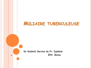 Overview of Miliary Tuberculosis and Its Clinical Manifestations