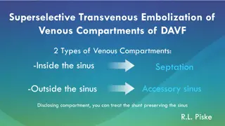 Superselective Transvenous Embolization of Venous Compartments in Dural Arteriovenous Fistulas