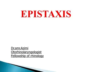 Nose Vascularity and Causes of Epistaxis