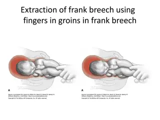 Innovative Delivery Techniques for Breech Births