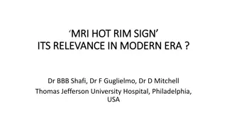 Relevance of MRI Hot Rim Sign in Modern Healthcare