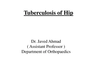 Tuberculosis of Hip: Causes, Symptoms, and Treatment Overview