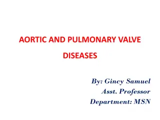 Aortic and Pulmonary Valve Diseases