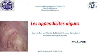 Appendicitis: Symptoms, Diagnosis, and Treatment Overview