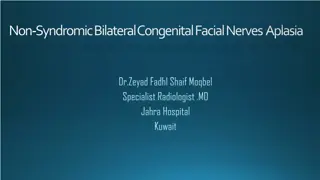 Rare Case of Bilateral Congenital Facial Nerve Aplasia