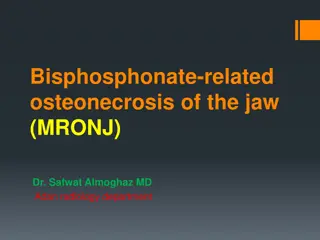 Bisphosphonate-Related Osteonecrosis of the Jaw (MRONJ) Radiological Findings