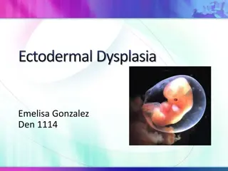 Ectodermal Dysplasia and Dental Treatments