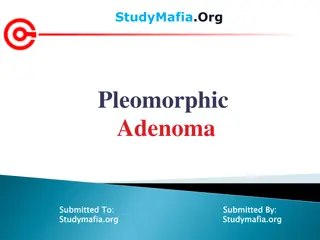 Pleomorphic Adenoma in Salivary Glands