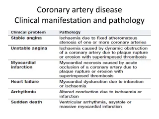 Coronary Artery Disease Manifestations and Angina Pectoris