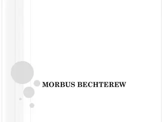 Morbus Bechterew: Symptoms, Diagnosis, and Prognosis