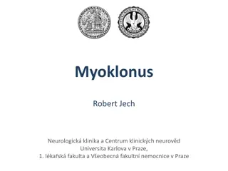 Myoclonus - Causes and Diagnostic Methods
